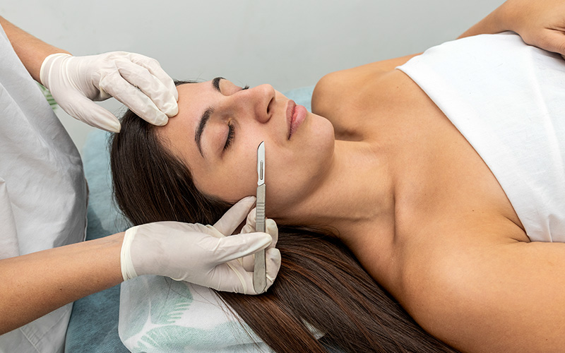 Dermaplaning